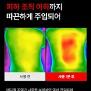 천메디칼 | “집에서 즐기는 병원급 온열 테라피, 루슨 메디컬 주열기 사용 후기”