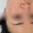 미2사단 정문 주차장 | 울산 에스테틱 프롬미 건조한 피부 필수 수분관리