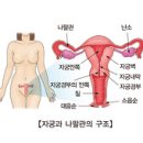 의학과한방(동영상):자궁경부암 (Cervical Cancer) 이미지