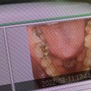 김민서치과의원 | [내돈내산] 서면 치과 추천 : 김민서 치과