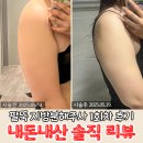 팔뚝 지방분해주사 가격 부작용 내돈내산 1회차 후기