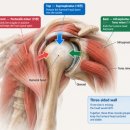 활인방 | 활인침법 각론 17편, 극하근·소원근 : 오십견·회전근개, 수술 없이 치료하는 침 치료?