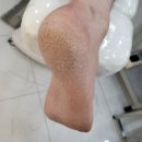 효성동 문제성발톱 개운했던 관리후기 [레푸스 부평 CGV점]