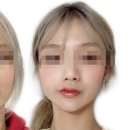 모자이크성형외과의원 이미지