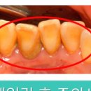 튼튼이치과의원 이미지