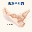 천하의 벽포 짐 이미지