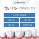 안정T치과의원 | 읍내동치과 임플란트도 수명이 있나요?