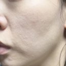 메디힐케어 | 올케어 추천템 메디힐 마데카소사이드 흔적 리페어 세럼, 후기