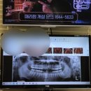 울산플러스치과의원 네이버블로그