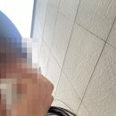 센텀약국 | [부산 센텀 치과]&#39;센텀아시아치과의원&#39; 사랑니 발치(비매복, 실밥터짐, 약국)