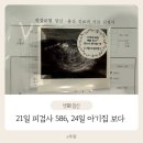 12월21일 피검586, 3일뒤 아기집 보고왔어요 4주차, 5주차 산부인과 방문후기