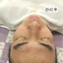 예쁘제에스테틱