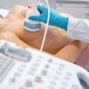정자센트럴산부인과의원 네이버블로그