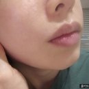 (주)지엠알 | &#34;지엠지엔르코스 저자극 폼클렌징 효소 세안제&#34;로 모공 청소 모낭염관리