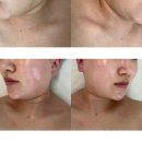 [천안 두정동] 성형없이 이뻐지는 얼굴 리프팅관리 두정동피부관리 &#39;비엘뷰티&#39;