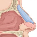 세가지소원성형외과의원 | 낮은코성형 결정 전, 성형외과 전문의가 알려드리는 핵심 정보