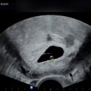 신림라움산부인과의원 네이버블로그