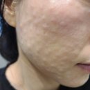 광주주월 밴스의원 네이버블로그