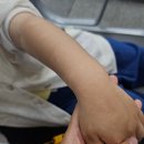 우태하한승경피부과의원 | 아기 백반증 의심 숙대 우태하한승경피부과 예약 없이 다녀온 후기 탈색모반 진단