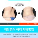 청담셀의원 이미지