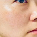 프라임365약국 | 리쥬치올 PDRN 1500ppm 퍼펙트크림으로 밸런스 케어 하기