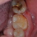 이랑치과기공소 이미지