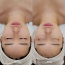레몬트리 | 남천동 레몬트리 에스테틱 내돈내산 후기