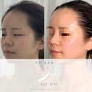 HJ산업 | 2차 관리에서 확 느낀 윤곽 변화, 칠암동 더안뷰티 후기