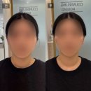 [김해] 트로이아스케 에스테틱