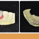 다이안치과기공소 이미지