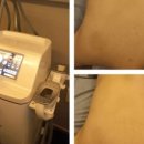 최프로 스킨 앤 바디 이미지