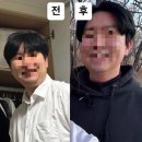 망포지하차도 | 수원 망포 아르모니아의원 온다 & 리프테라2: 예비신랑관리 내돈내산 찐후기