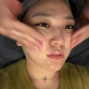 비알팜 | 압구정피부과 뜨고있는 <비타란>스킨부스터 PN주사 2cc (리쥬란보다 안 아플까?) 통증/가격/후기