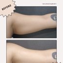 골드스킨&바디 이미지