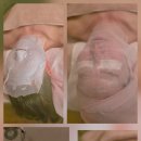 블링S스킨케어