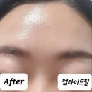 [소호테라피/인천피부샵] 귀족필링&amp;두피 아로마 테라피 후기! 펩타이드 특수 필링