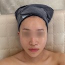 신평3길 | 군산 지곡동 르씨엘에스테틱 이중턱 라인케어 윤곽관리 후기