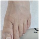 엄마 발 아파 힘들었던 지난날 끝!일산 엄소아과의원에서 변화