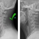 종로아산본정형외과의원 이미지