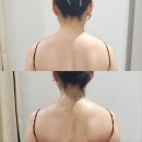 전주 체형관리 아띠뷰티살롱 에어바디 승모근 다이어트