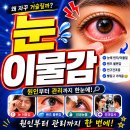 송탄성모안과의원 네이버블로그