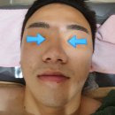 허니클(Honeycle) | 광교 피부관리샵 허니클 아크네피부관리 후기