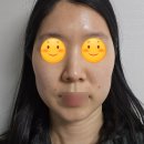 중계의원 | 중계의원 주근깨 리터치 후기