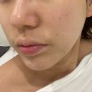 4723 | 대전 피부관리 봉명동 프롬미 바이오힐 속건조 관리 후기