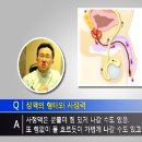 [정관수술/코넬비뇨기과]정관수술후 무정자증인데 임신이?[정관수술] 이미지