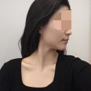 목동피부관리샵 엑스날 목동점에서 한달남은 예신이 관리