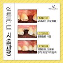 민승기브이라인치과의원 이미지