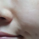 피부미인만들기