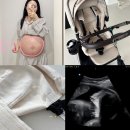 37 2도 | [말띠맘 임신일기] 36~37주 아티포페, 실버크로스 듄2, 리베르여성병원 막달검사, 태동검사, 출산가방