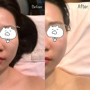 조암남로 | 대구 달서구 피부관리ㅣ월성동 은가비 알테온 탄력·윤곽 케어 리프팅 후기